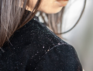 What Causes Hair Dandruff