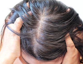 What causes Oily Scalp | Solution for Oily Scalp