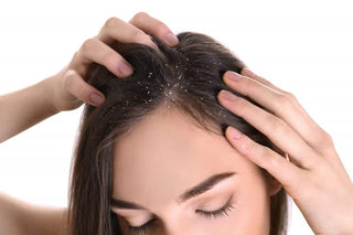 Is Dandruff a Fungus?