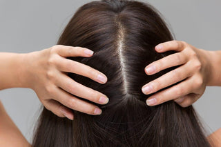 6 Common Types of Scalp Problems and How You Can Treat Them Right Away